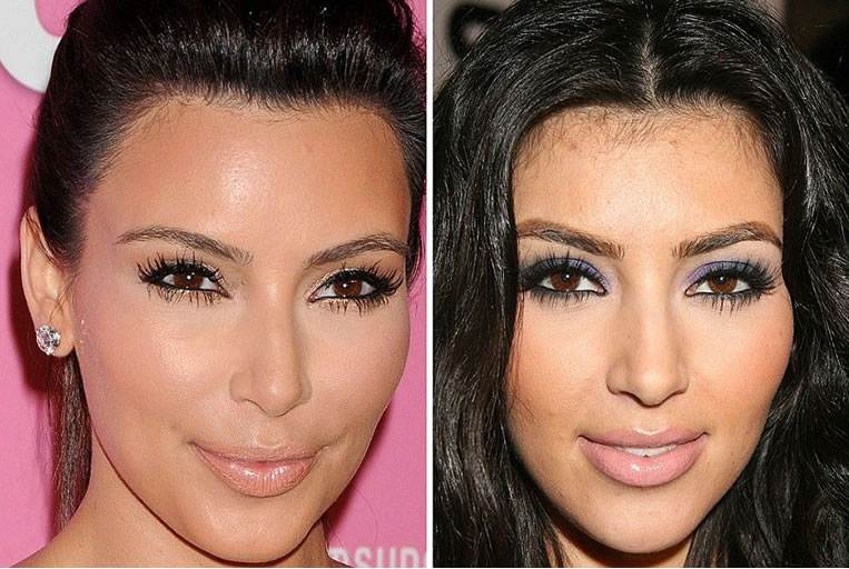 profesional confirmar Viaje La pasión de Kim Kardashian por la depilación: Láser Diodo LightSheer -  Quintalegre Clínica Médico Estética